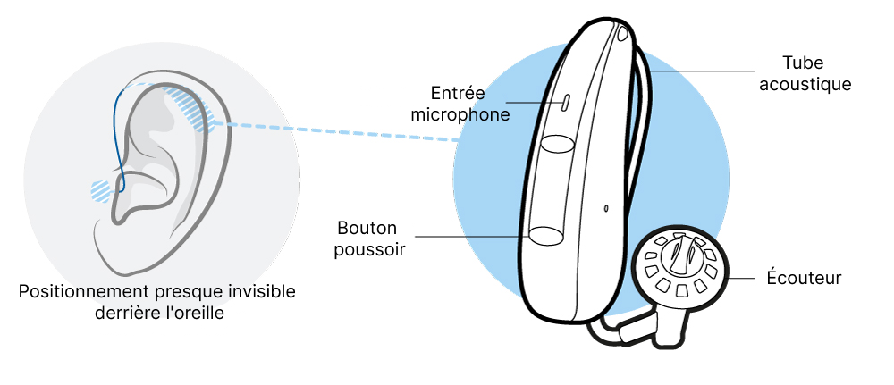 Appareils Auditifs Contours D Oreille Audibene